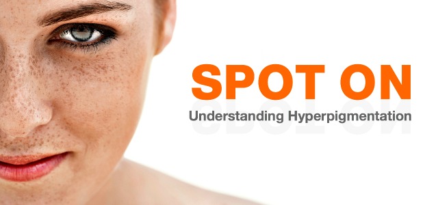 Understanding Hyperpigmentation